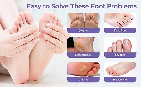 SADOER Goat Milk Nicotinamide Exfoliating Foot Mask