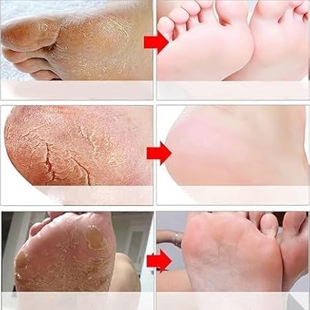 SADOER Goat Milk Nicotinamide Exfoliating Foot Mask