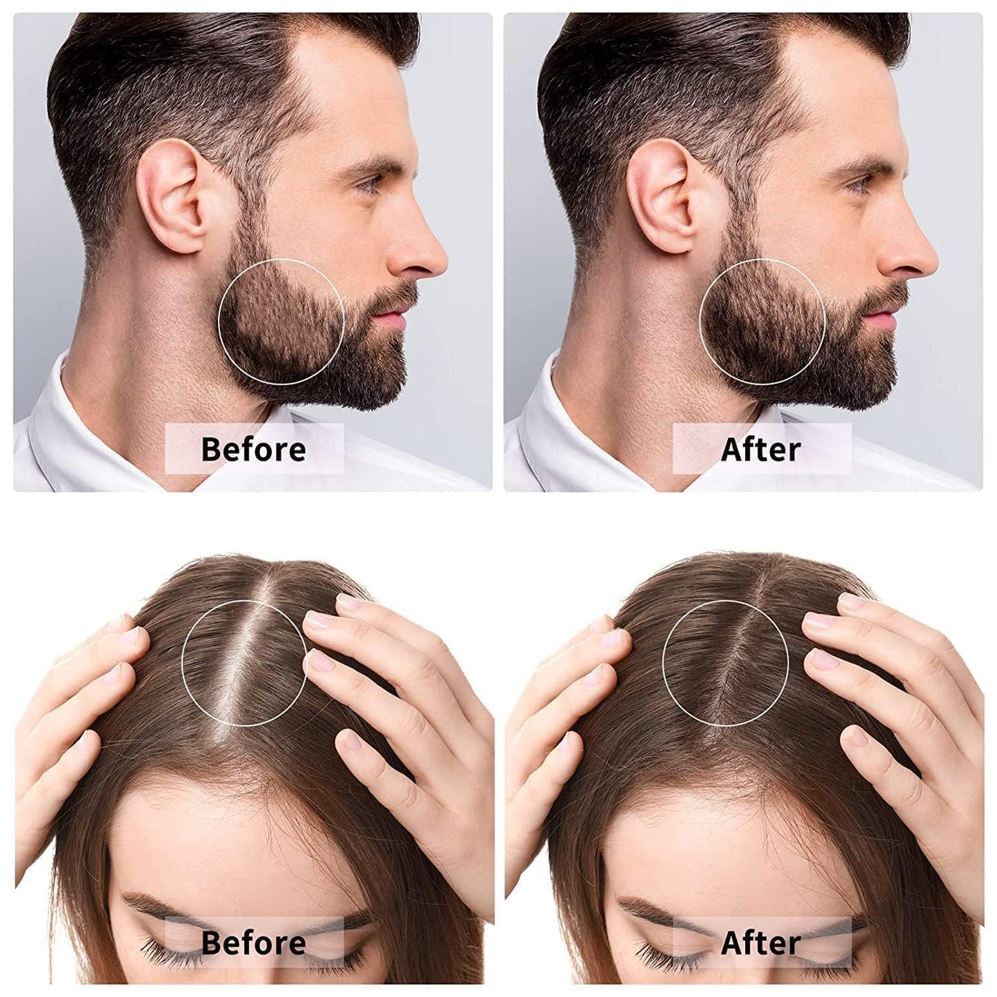 Advanced Titanium Derma Roller