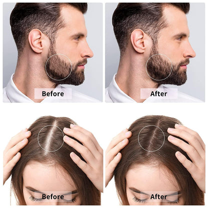 Advanced Titanium Derma Roller