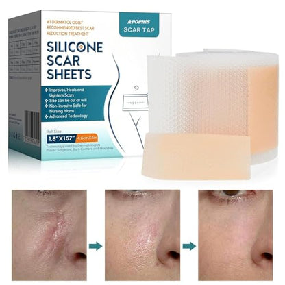 Silicone Scar Sheets Roll
