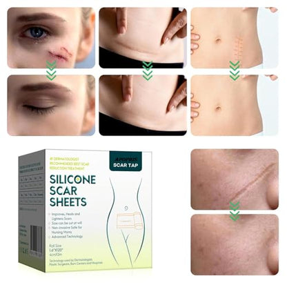 Silicone Scar Sheets Roll