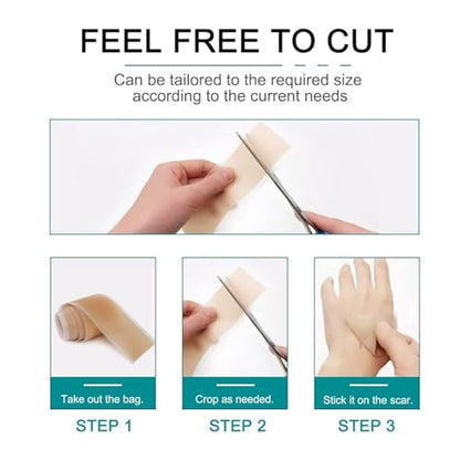 Silicone Scar Sheets Roll