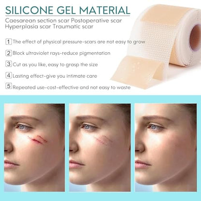 Silicone Scar Sheets Roll