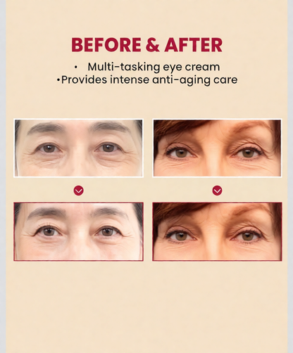 SEOUL 1988 Hydrating Eye Cream